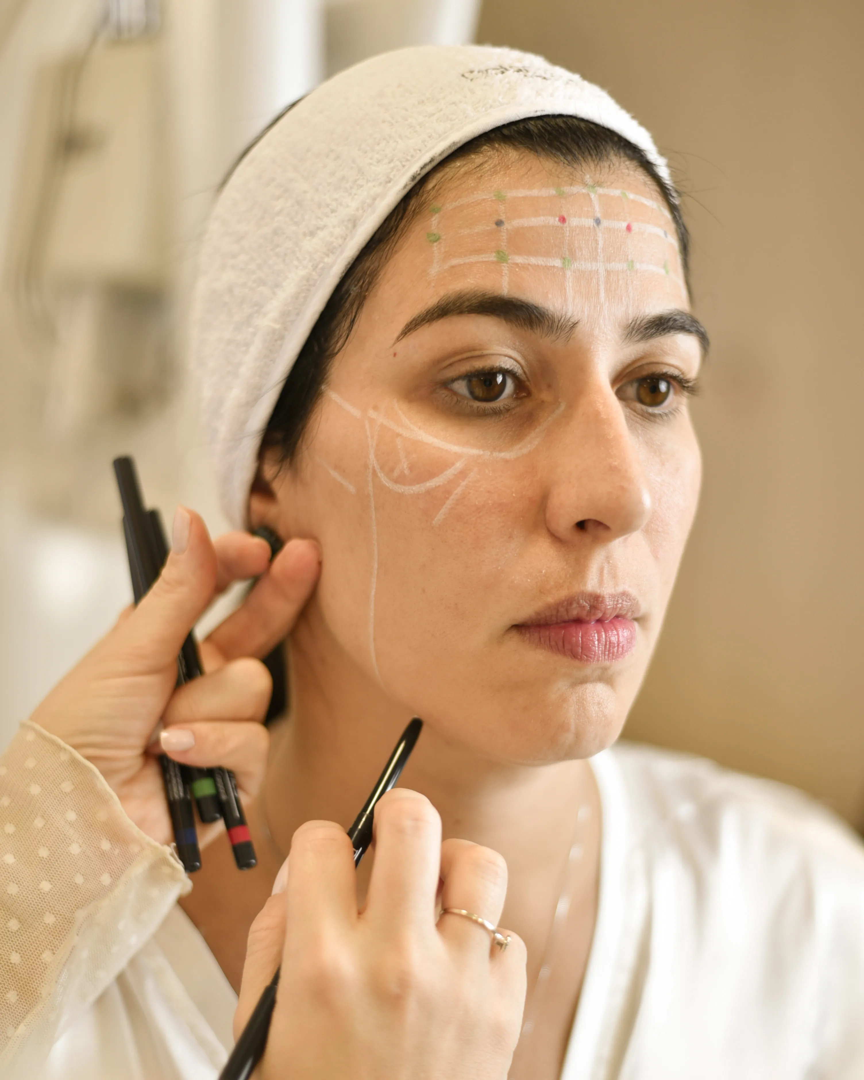 Tratamento para Cicatriz de Acne - Marcas e cicatrizes residuais deixadas pela acne